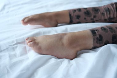 Yataktaki kuru çocuk ayaklarını kapat.