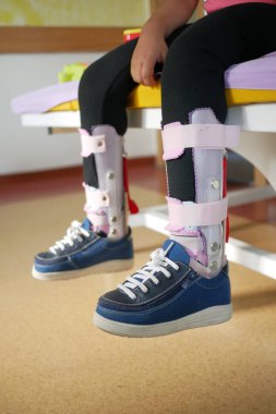Çocuk serebral felç, bacak ortozu.