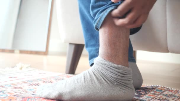 Άνθρωπος Που Πάσχει Από Κνησμό Του Δέρματος Στα Πόδια Του — Αρχείο Βίντεο