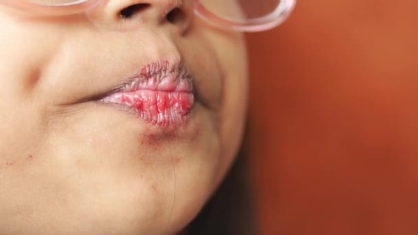 紧闭孩子干裂的嘴唇 — 图库视频影像