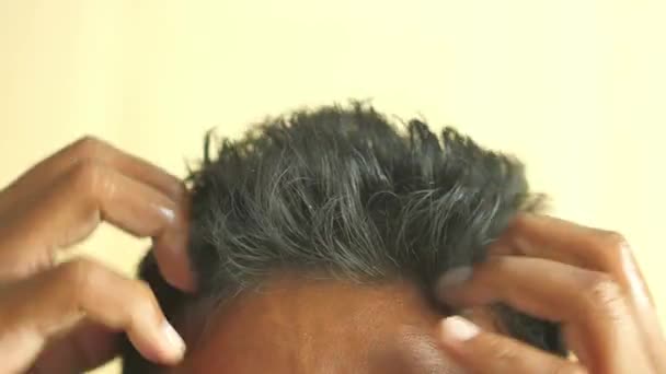 Laki Laki Scratching Kepalanya Closeup — Stok Video