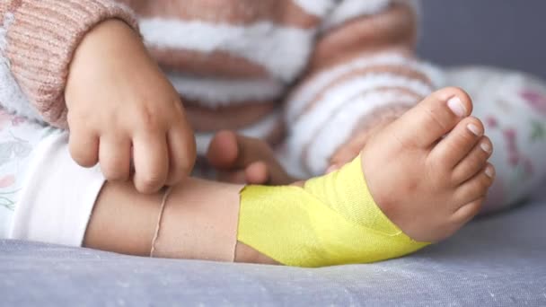子供の足に適用される伸縮性のある治療的な黄色いテープ ケインシオ タッピングセラピー — ストック動画