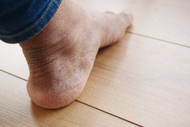 Genç adamlara yaklaşın. Ayaklar kuru. ,