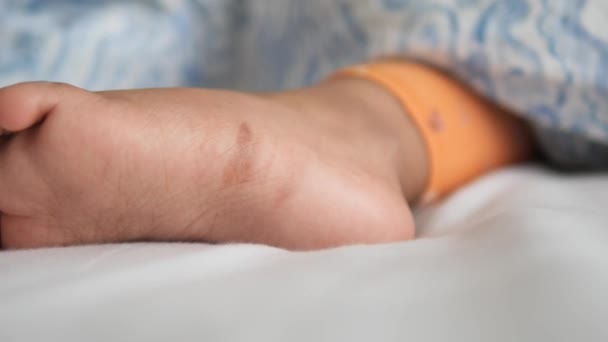子供の足にステッチされた傷跡 — ストック動画