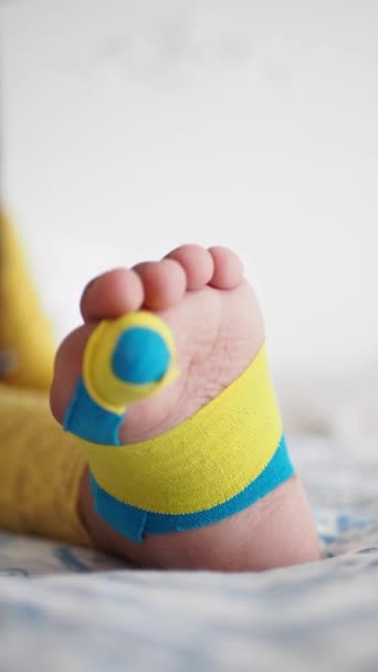 子供の足に適用される伸縮性のある治療ブルーテープ ケインシオ タッピングセラピー — ストック動画