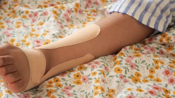 子供の足に適用される伸縮性のある治療テープ ケインシオ タッピングセラピー — ストック動画