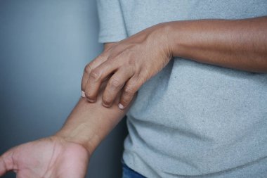 Kaşındıran deriden muzdarip bir adam. Yaklaş.