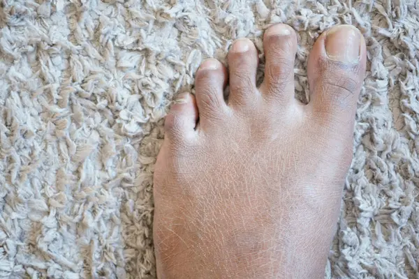 close up of young man dry feet on floor ,