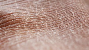 Kuru insan derisinin yakın görüntüsü