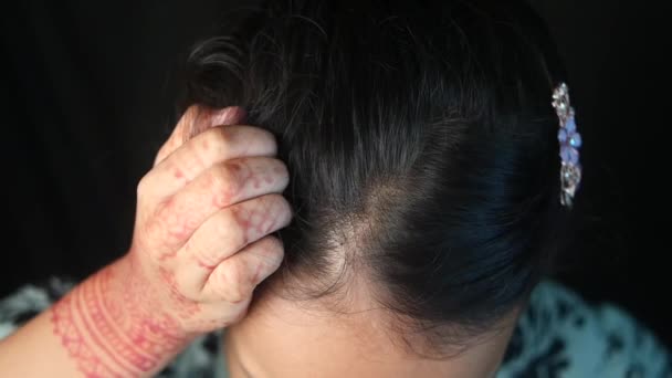 Gadis Kecil Menggaruk Tampilan Atas Kepalanya — Stok Video