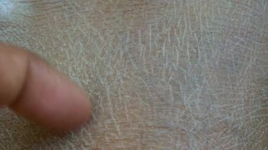 Kuru insan derisinin yakın görüntüsü