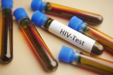 Renk arkaplanında HIV kan testi tüpü .
