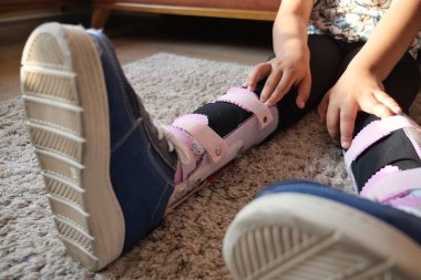 Çocuk serebral felç, bacak ortozu.