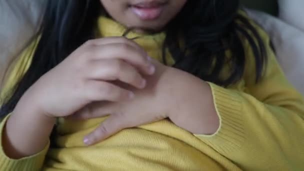 Ett Barn Som Lider Klåda Hud Hennes Hand — Stockvideo