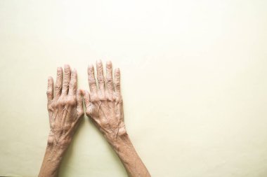 Yaşlı bir insanın ellerini kapat. ,