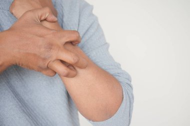 Kaşındıran deriden muzdarip bir adam. Yaklaş.