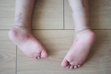 A childs bare feet on a wooden floor, representing innocence and playtime at home clipart