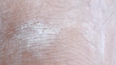 Kuru insan derisinin yakın görüntüsü