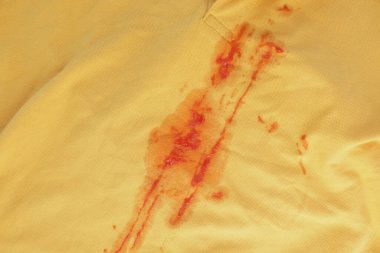 Sarı bir gömleğin üzerine sıkılmış bir şişeden dökülen ketçap kirli bir lekeye neden oldu.