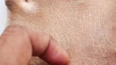 Kuru insan derisinin yakın görüntüsü
