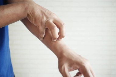 Kaşındıran deriden muzdarip bir adam. Yaklaş.