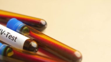 Sarı arka planda HIV kan testi tüpleri ,