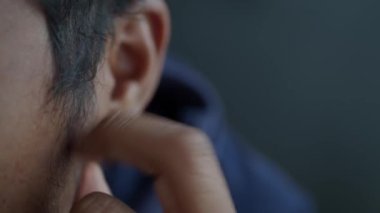 Saçında kepek olan bir adam, yakın plan. .