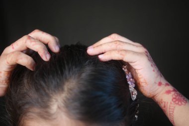 Başını kaşıyan bir çocuk.