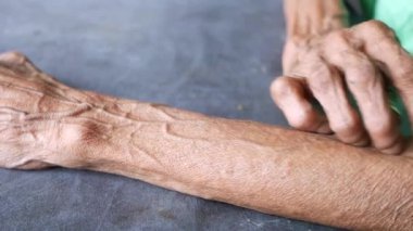 Kolunu kaşıyan yaşlı biri..