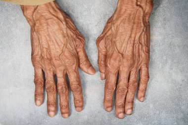 Yaş ve deneyim gösteren yaşlı bir bireyin elleri dinlenirken.