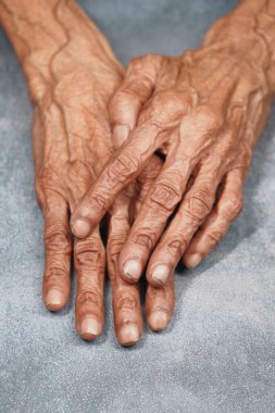 Yaşlı bir insanın elleri gri bir yüzeyde rahatlar ve yaşını gösterir..