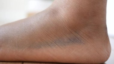 Ayak bileğinde belirgin bir koyu renk yama görülüyor. Bu da muhtemel sorunları gösteriyor..