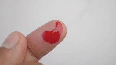 Parmağında kan olan bir adam..