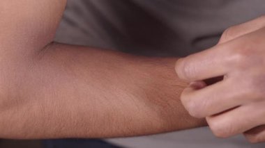 Koldaki deri tahrişini azaltmak için etkili yöntemler gösteriliyor.