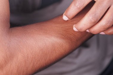 Kişi derisini kaşındırıyor. ,