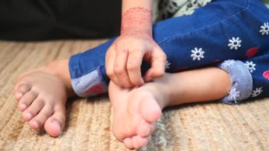 Çocuklar ayaklarında kaşınıyor. .