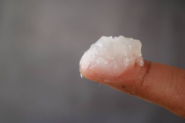 Cilt bakımı için parmak ucuna yağ jölesi uygulanır.,
