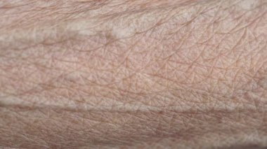 Kuru cilt dokusu yakın plan benzersiz desenleri ve ayrıntıları gösterir,
