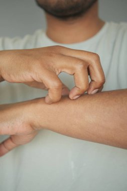 Bir adam içeride dururken kolunu kaşıyor, rahatlamaya odaklanmış..