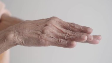 Benzersiz doku ve çizgiler sergilenen yaşlanmış bir elin yakın çekimi.