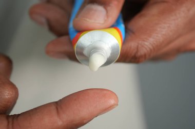 Eller cilt bakımı için tüpten parmağa krem sürerler..