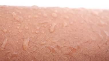 Cilt yüzeyindeki su boncukları, dokuyu ve detayları canlı bir şekilde vurgular.