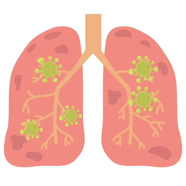 stock vector Virus or bacterial infects lungs.virus invades lungs.