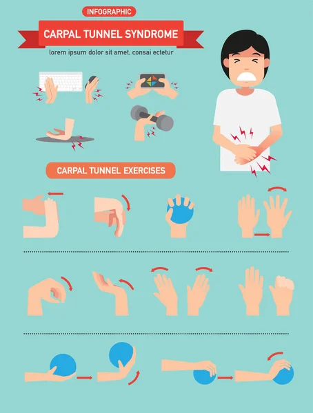 Illustration Vectorielle Infographique Syndrome Canal Carpien — Image vectorielle