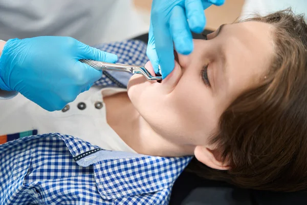 Boy Having Tooth Removed Dental Clinic Special Tool Doctor Works — Stock Photo, Image