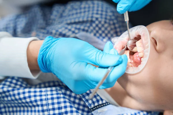 Dentista Examina Cavidad Oral Niño Guantes Protección Médico Utiliza Herramientas — Foto de Stock