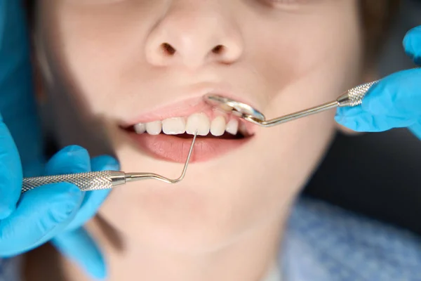 Dziecko Egzaminie Dentysty Gabinecie Stomatologicznym Specjalista Używa Specjalnych Narzędzi — Zdjęcie stockowe