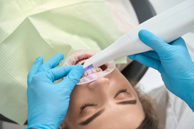 Stomatologların ellerindeki nitrile eldivenlerle yakın plan çekimleri kadın ön dişlerini intraoral tarayıcı ile inceliyor