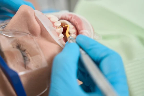 Læge Hænder Fjerne Tandsten Fra Tandoverfladen Tandkødet Kvindelige Patient - Stock-foto