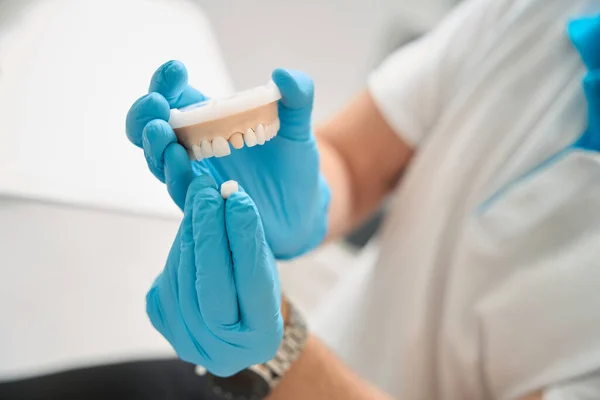 手持牙冠和上颌牙模的一次性硝酸盐手套中牙科医生的剪影 — 图库照片